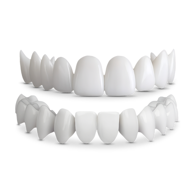 Shiny Smile Veneers Official Website