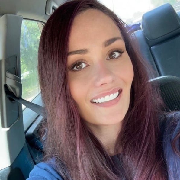 Shiny Smile Veneers Reviews 1