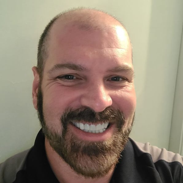 Shiny Smile Veneers Reviews 2