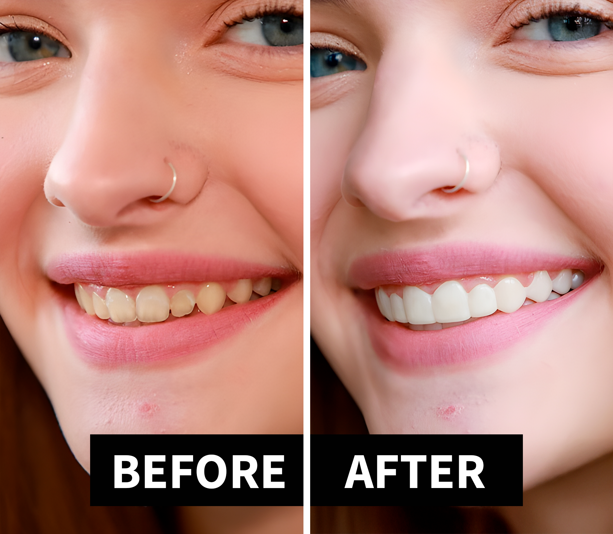 Shiny Smile